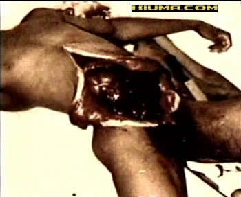 RE: Jeffery Lionel Dahmer Revisited (Extremely Graphic Pictures NSFW at all...